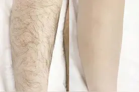 为什么有的女性体毛旺盛，有的却“光秃秃”？看完涨知识了图片