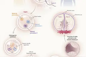 19岁女孩生下双胞胎，孩子竟有2个父亲？医生这么解释……图片