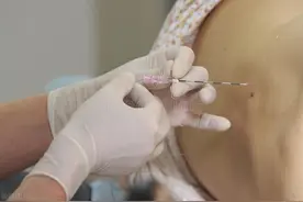 剖宫产后腰痛是麻醉惹的事吗？图片