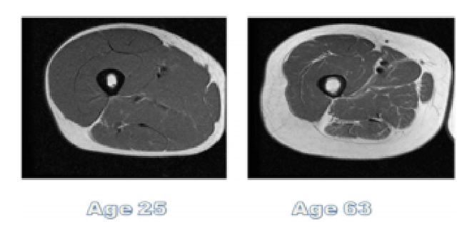 支链氨基酸作为老年营养关键共识，竟被美专家否定？营养师来解读