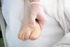 患上肾病，为什么会水肿？看过答案，送你两个利水消肿的小妙方图片
