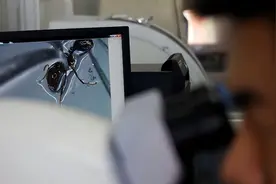 又是红火蚁咬伤，专家提示：不容小觑，可产生过敏性休克图片