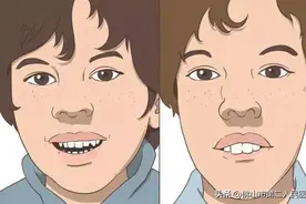 孩子张嘴睡觉，还越长越丑？当心是腺样体肥大，危害比你想的严重！图片