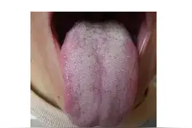 人长得不胖，肚子却很大，是脾虚吗？中医教你一个简单实用的方法图片