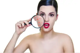 痘痘总是反复发作？多半是中了3个误区！3个方法帮你有效祛痘图片