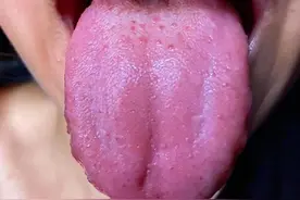 半夜潮热盗汗，睡不好觉，怎么办？图片