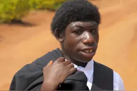 非洲23岁男孩酷似猿猴，不会说话只会叫，是何让他获取粉丝1000万图片