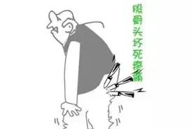 腰疼？腿疼？股骨头坏死在作祟，不要让它成为漏网之鱼图片