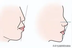 不得不承认，凸嘴对一个人的颜值影响还是蛮大的！（老路说真相）图片