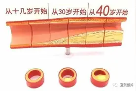 血管的质量决定您生活的质量图片