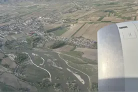 女子拔牙后坐飞机伤口出血，日常养护这些事项要注意图片