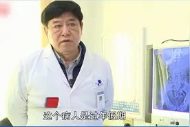 男子跳绳急发腰痛呕吐 专家提醒：跳绳不是解决所有结石病的良方图片