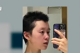 长发及腰到光头“小子”，我的发量焦虑消失了｜我的健康故事图片