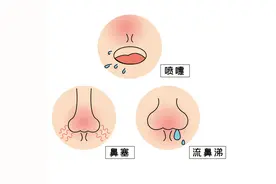 鼻子为何老是堵？原因和应对方法看过来～图片