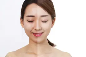 记者亲历“打脸”项目，雀斑晒斑通通“掉落”，寒假这些变美项目重磅优惠！图片