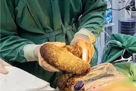 确诊！广东一名11岁女孩患上“公主病”图片