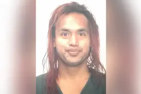 或将永久性毁容！中国女教师在美被泼化学液体案最新进展图片