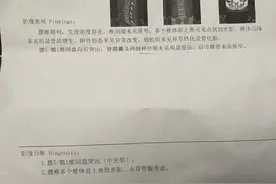 杭州一27岁女子摔跤后被确诊……妈妈崩溃：这么年轻怎么会？图片