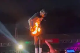 巴西一歌手演出时，短裤被喷火装置点燃，腿部烧伤图片