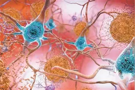 抗衰老疫苗助力健康晚年图片