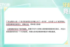 牙龈长包竟是“癌”？改掉这几个不良习惯 现在还不算晚图片