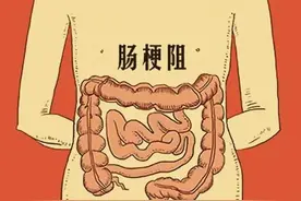 饭后剧烈运动，饭后一动不动，都要小心这种肠道急症图片