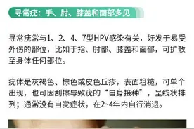 感染HPV身体会有哪些变化？图片