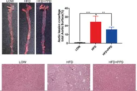 三七皂苷治疗动脉粥样硬化分子靶点首次发现图片