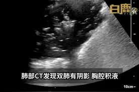 一家五口突然高热，原来是外公养了一只鹦鹉图片