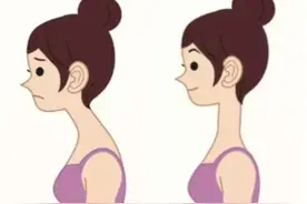 教你几招，告别含胸驼背图片