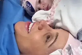 八万分之一的概率：巴西女婴裹在透明羊膜囊内出生图片