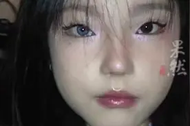 18岁女孩天生一只眼睛是蓝色，女孩：有人骂我是蓝眼睛怪物图片