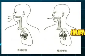 憋气不足40秒就说明肺有问题？缺乏科学依据！图片