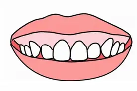 【健康科普】关于牙齿矫正那些事儿图片