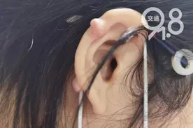 这个“肉疙瘩”是啥？爱美姑娘一个常见举动……崩溃图片