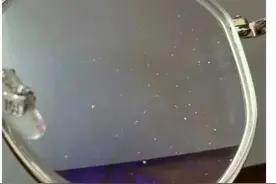 眼镜上出现白点？这类人群要格外注意！图片