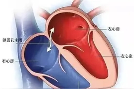 台州女子“生不如死”40多年，终于找到“元凶”！20%的成人都有，千万别忽视！图片