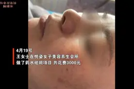 “美容”变“毁容” 女子祛斑不成反长一脸黑“斑”……图片