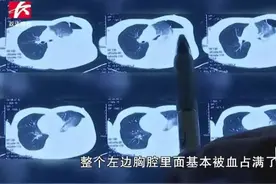 18岁小伙健身后肺“炸”了，这类人群高发图片