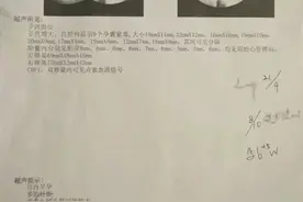 怀上9胞胎女子丈夫回应：决定减胎！图片
