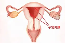 一会儿厚，一会儿薄，子宫内膜知多少？图片