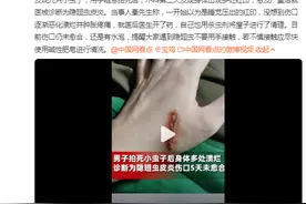 男子拍死隐翅虫多处溃烂5天未愈 友情提醒：遇到隐翅虫千万别用手拍图片