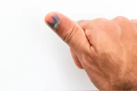当心！指甲出现这个变化，有可能是癌变！千万要警惕！图片