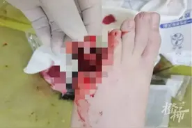 又是它！8岁男孩脚趾被夹断，这种鞋，很多人爱穿！图片