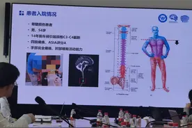 大脑，与电极共存——一个国产脑机接口案例图片