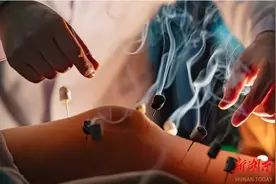 "艾灸是我最想做的事业！”王祖贤官宣开办艾灸馆，艾灸究竟有多好？图片