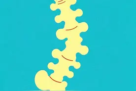 眼睛疼竟然查出是强直脊柱炎图片