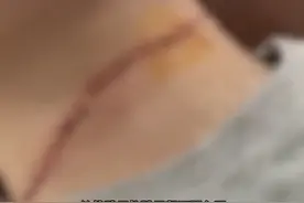 必须注意！2天3起风筝线危害行人事件图片