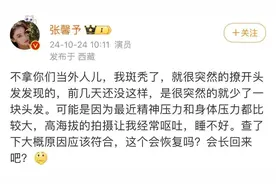 知名女演员自爆“斑秃”，压力是根源？头发还有望再长回来吗？图片