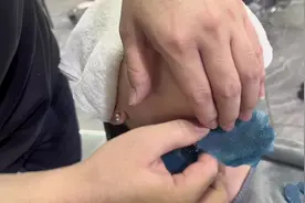 蜜蜡拔胡子，绝对刺激！#大庆男士理发店#男士修面视频封面